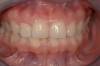 4 - particolare dei denti incisivi