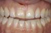 3 - particolare dei denti incisivi